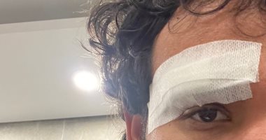 عاجل: 4 غرز لـ محمود علاء فى أول مشاركة مع الاتحاد السكندرى.